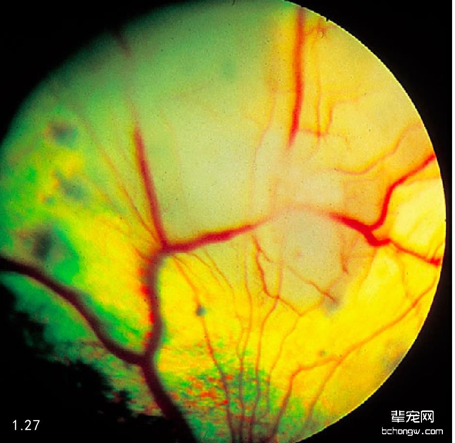 犬酵母菌病引起的视网膜下渗出物。