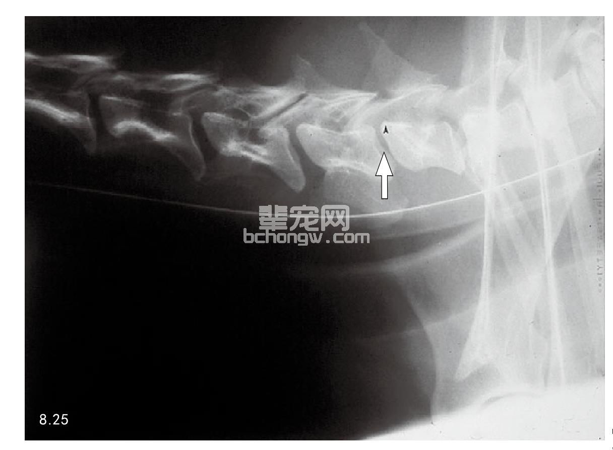 椎间盘病