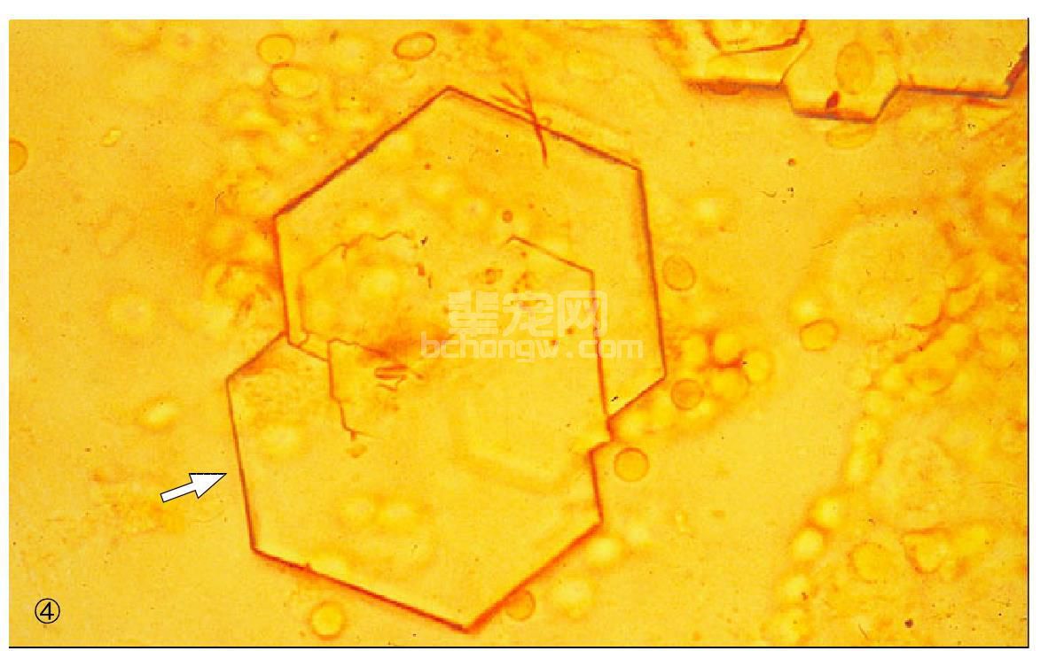 40 尿液中结石的晶体图像(箭头所指):①鸟粪石;②草酸钙;③尿酸铵;④