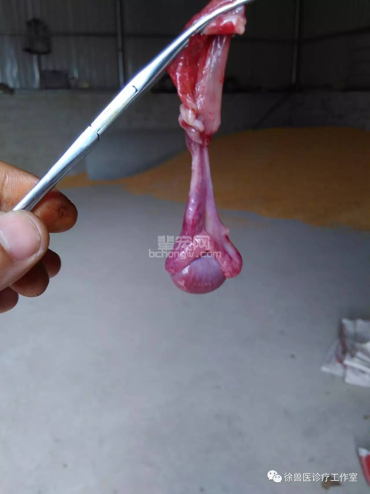 这就是结扎并摘除后的睾丸精索总鞘膜