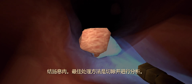 大肠的复仇