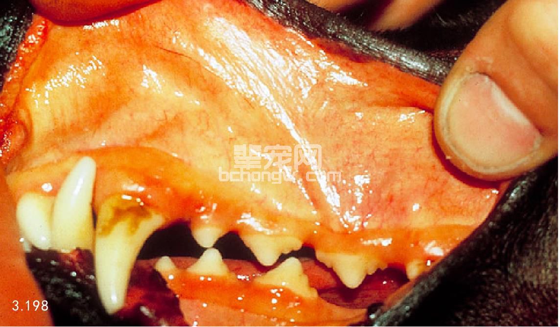 慢性炎性肝脏疾病