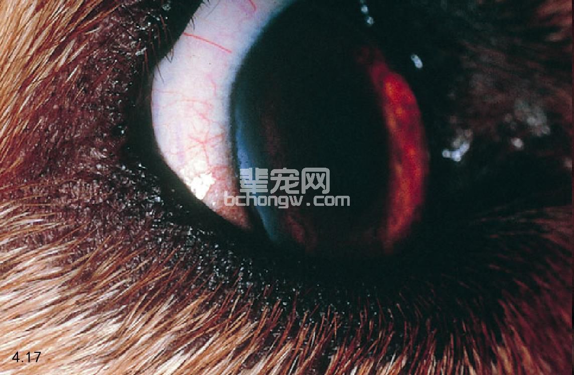 甲状腺功能减退