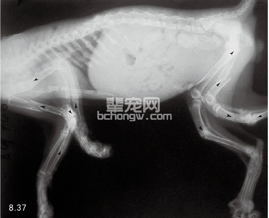甲状旁腺功能亢进