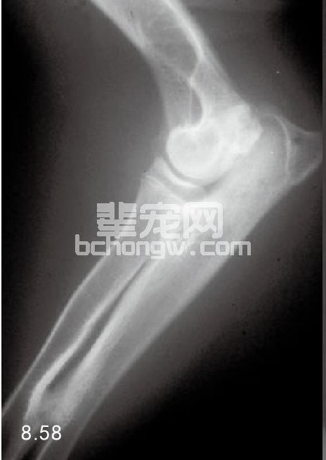骨连结