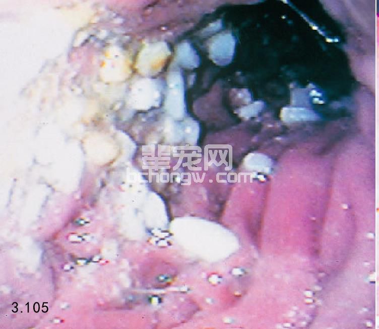 慢性胃炎