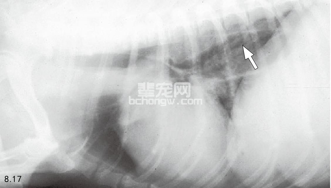 重症肌无力