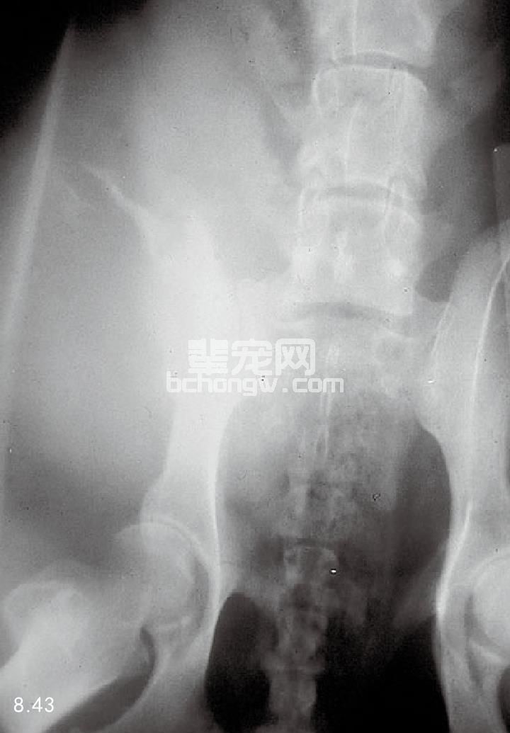 骨的血管瘤