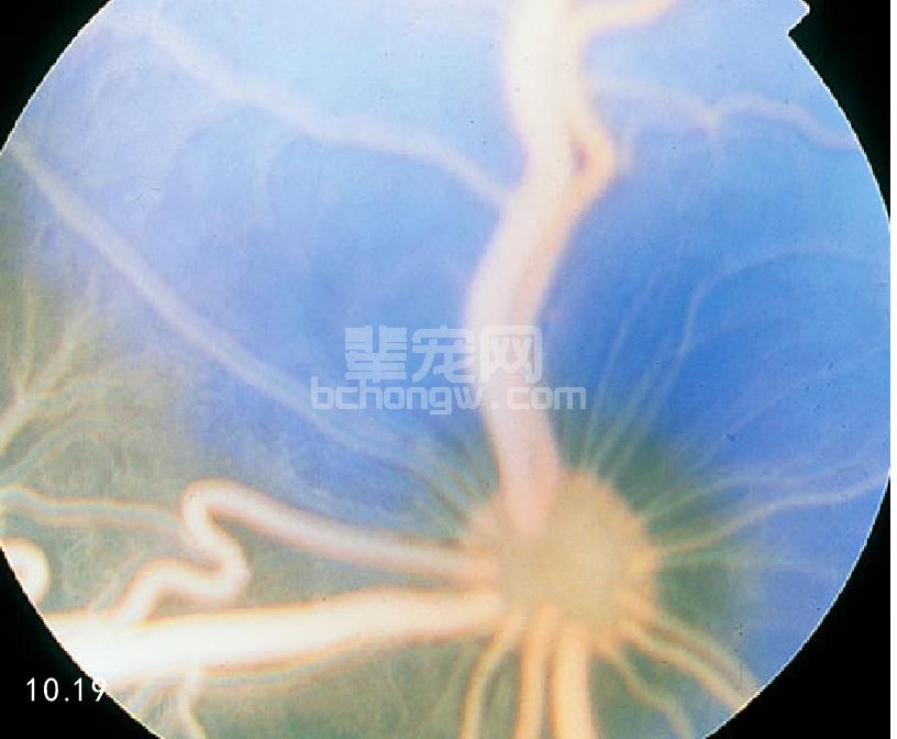 高脂血症