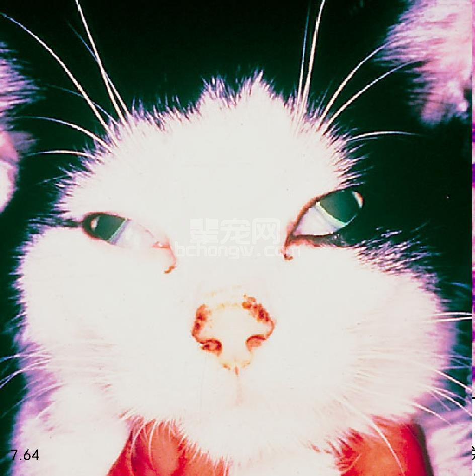 家族性自主神经功能障碍
