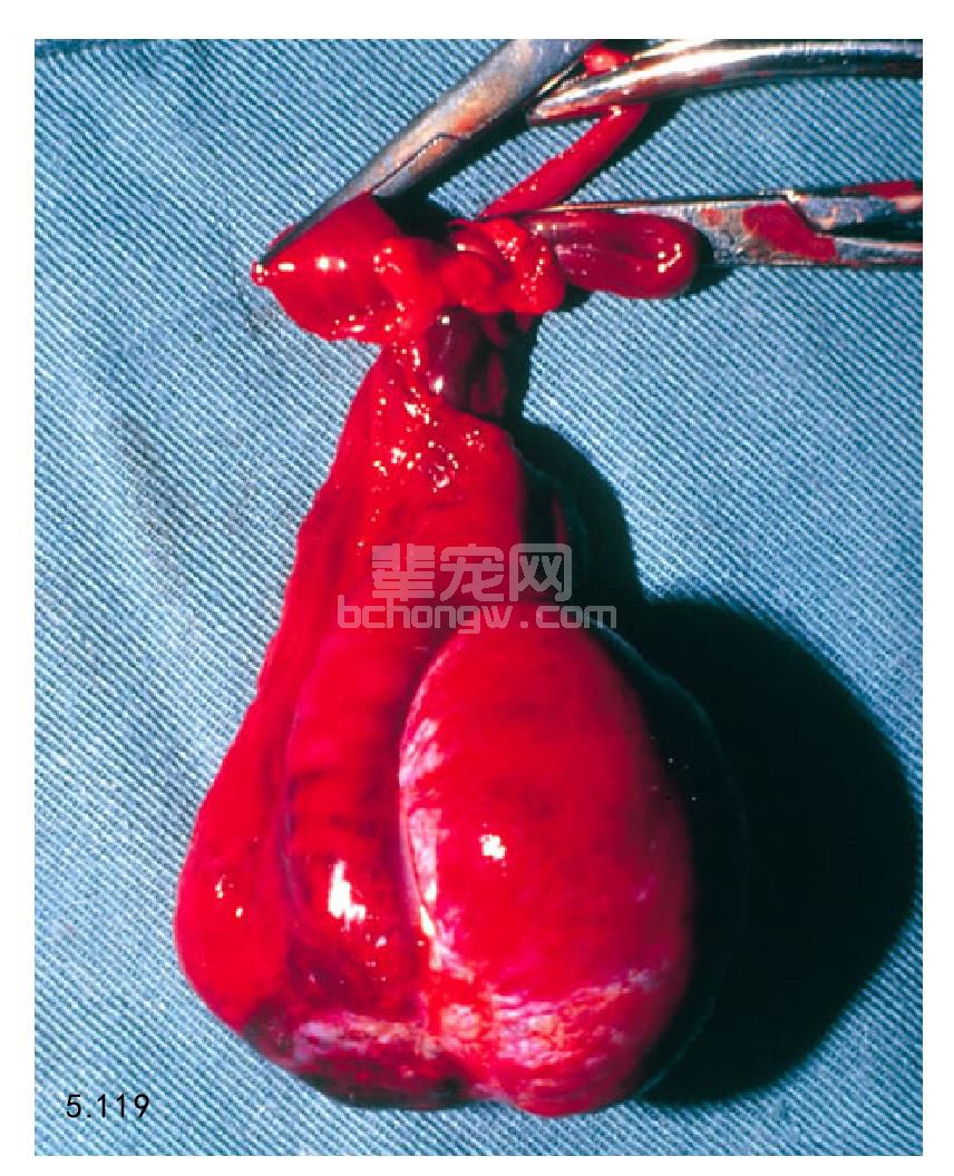 睾丸扭转