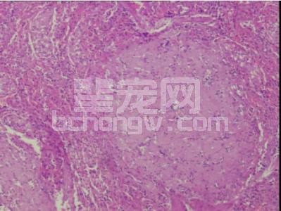 皮质类固醇引起的白细胞增多症