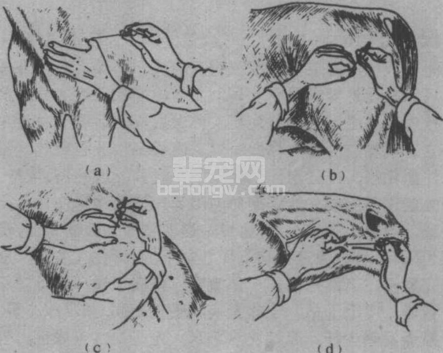 针刺方法