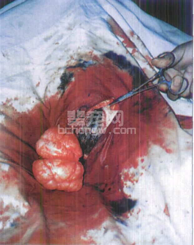 图2-16 犬会阴部纤维瘤