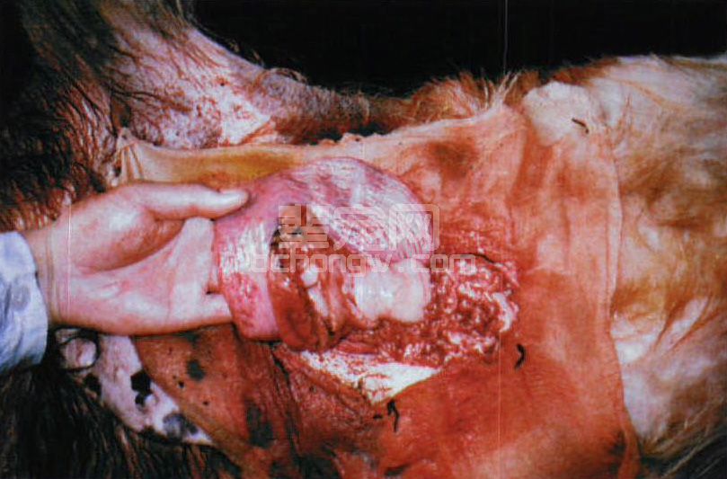 图3-16 子宫破裂