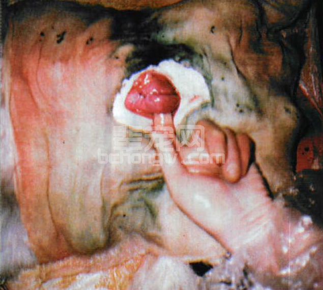 图3-17 剖腹产子宫缝合后