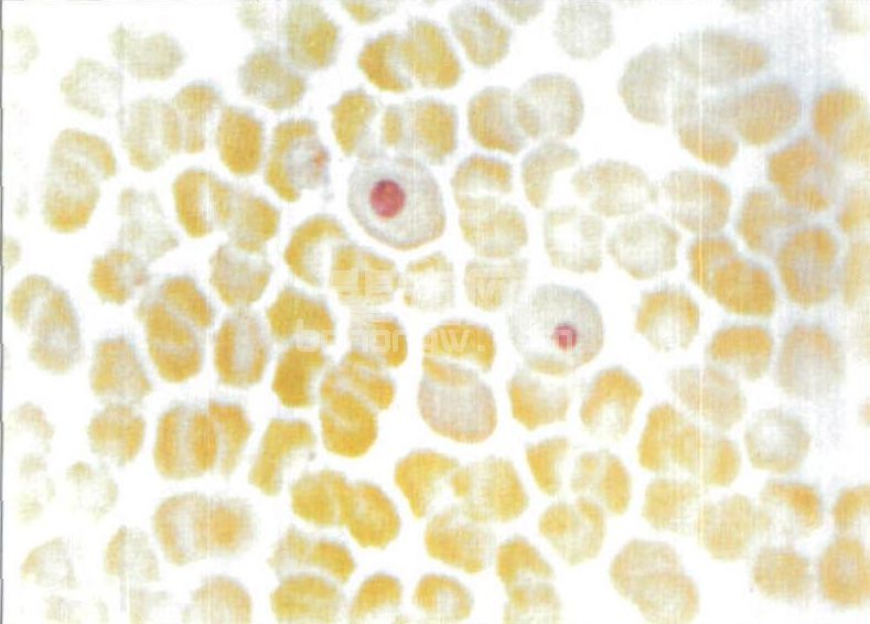 图4-8 极少见的红细胞内犬瘟热病毒包涵体