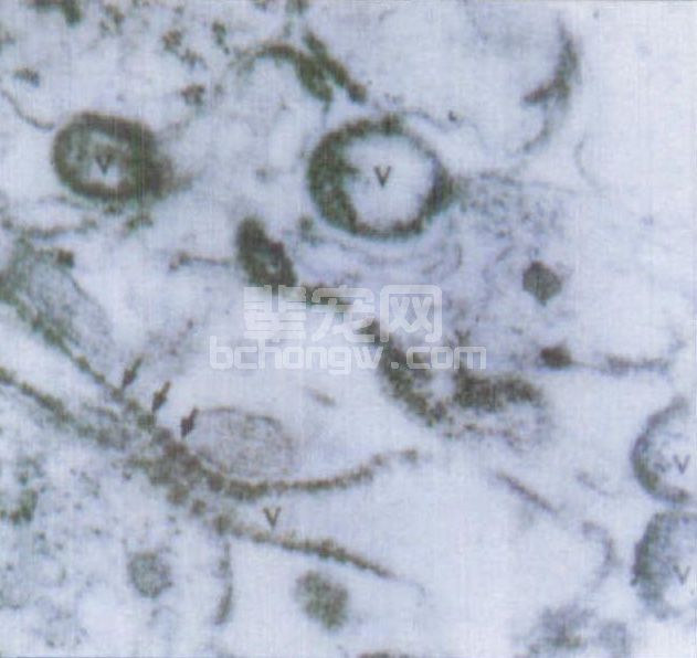 图4-1 犬瘟热病毒粒子