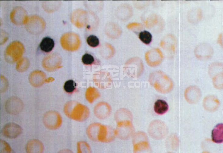 图4-6 铅中毒骨骼中存在大量幼红细胞堆积