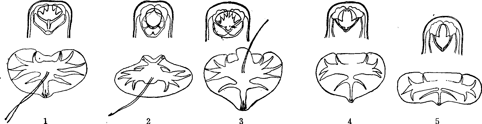 钩虫与钩虫病