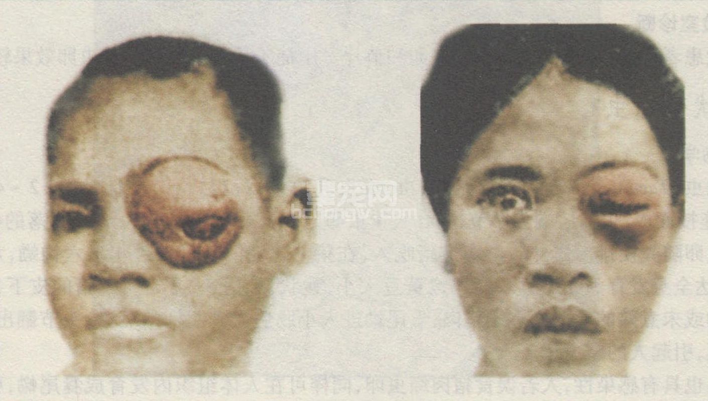 第二节 绦虫