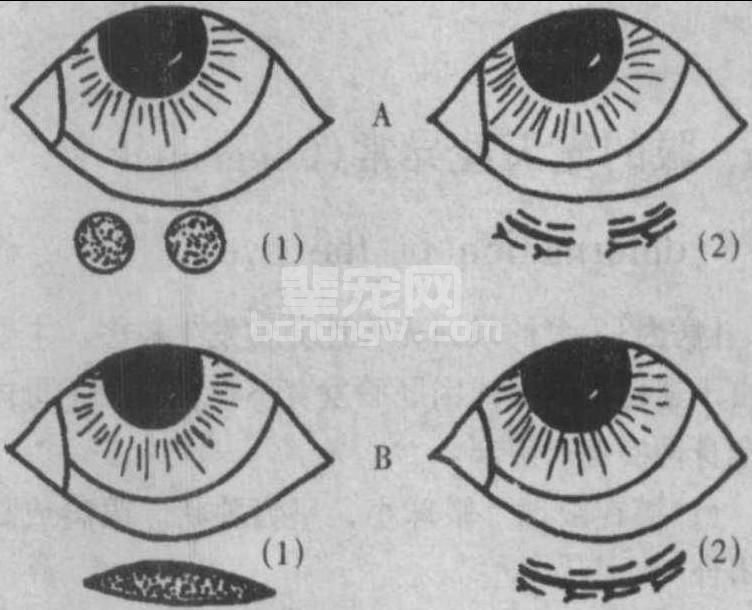 三、眼睑内翻