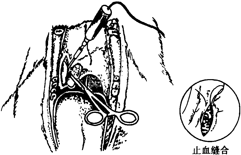 五、表现为口腔异常的疾病(口炎、口臭)