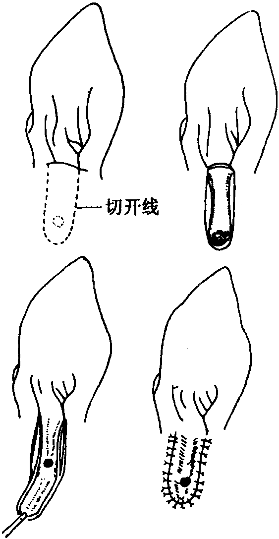 三十四、耳的疾病