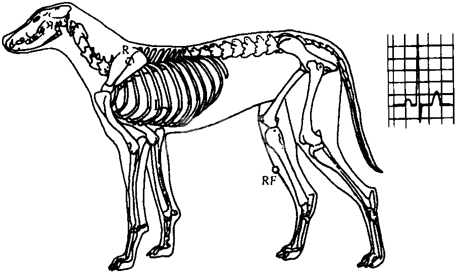 (一) 心电图检查
