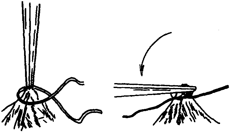 (三) 止血法