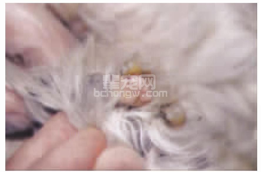 皮脂腺瘤