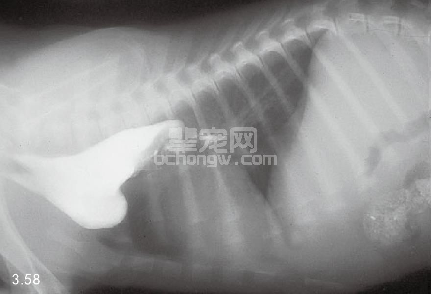 3. 食管腔外性压迫