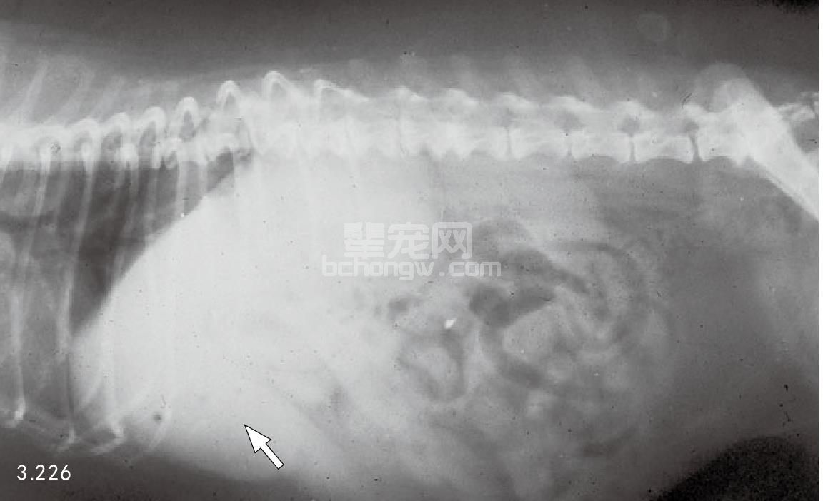 12. 糖肾上腺皮质激素性肝脏疾病