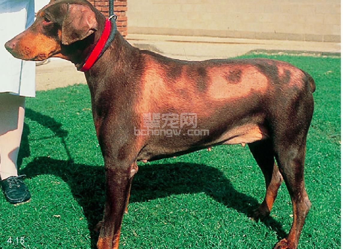 1. 甲状腺功能减退