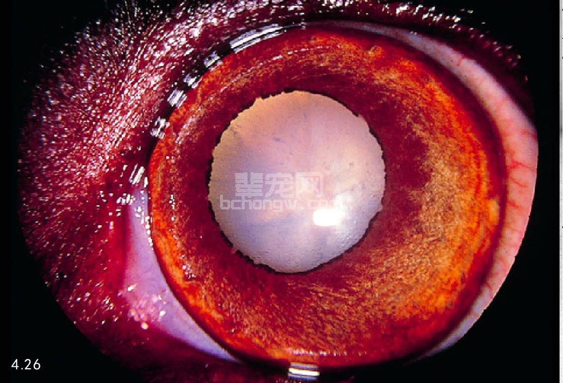 1. 甲状旁腺功能减退