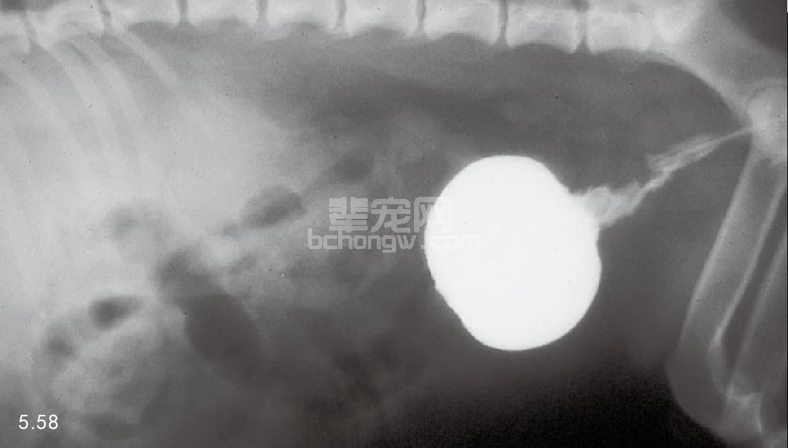 （4）前列腺腺癌