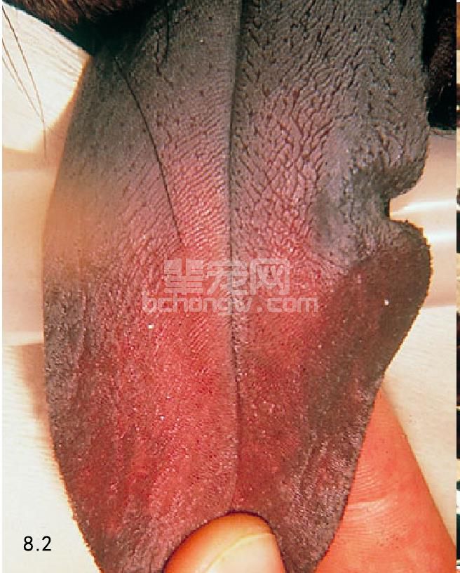 1. 肌强直