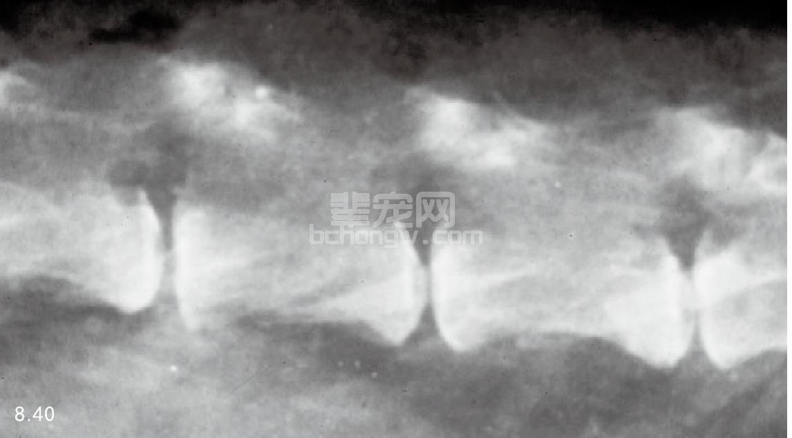 6. 肾上腺皮质功能亢进