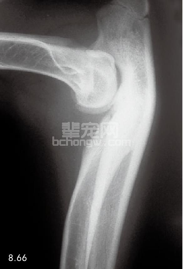 2. 脱臼