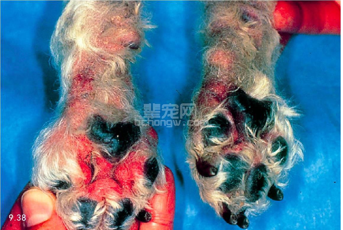 2. 马拉色菌性皮炎