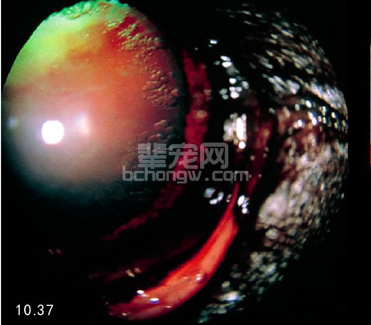 12. 糖尿病