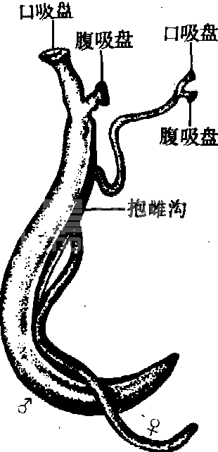分体吸虫病