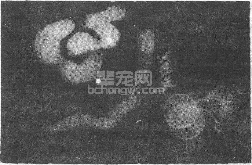 腹部疾病X线诊断