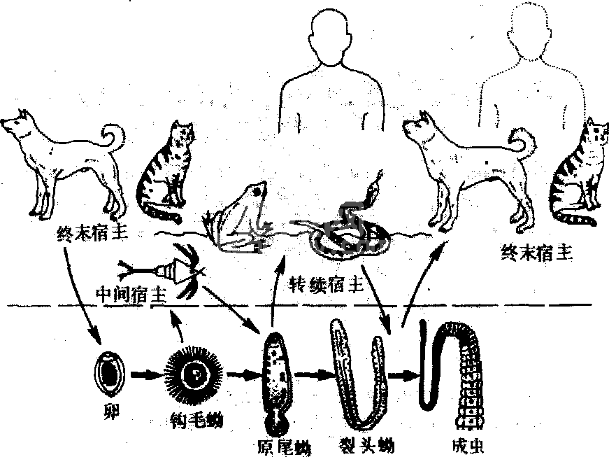 曼氏裂头蚴病