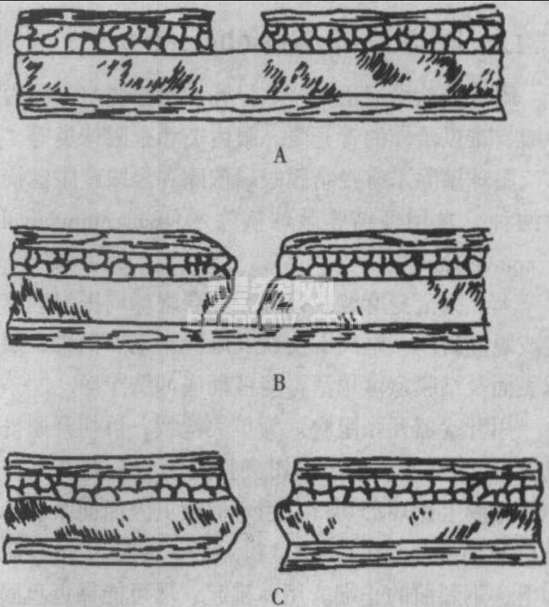二、耳的撕裂创