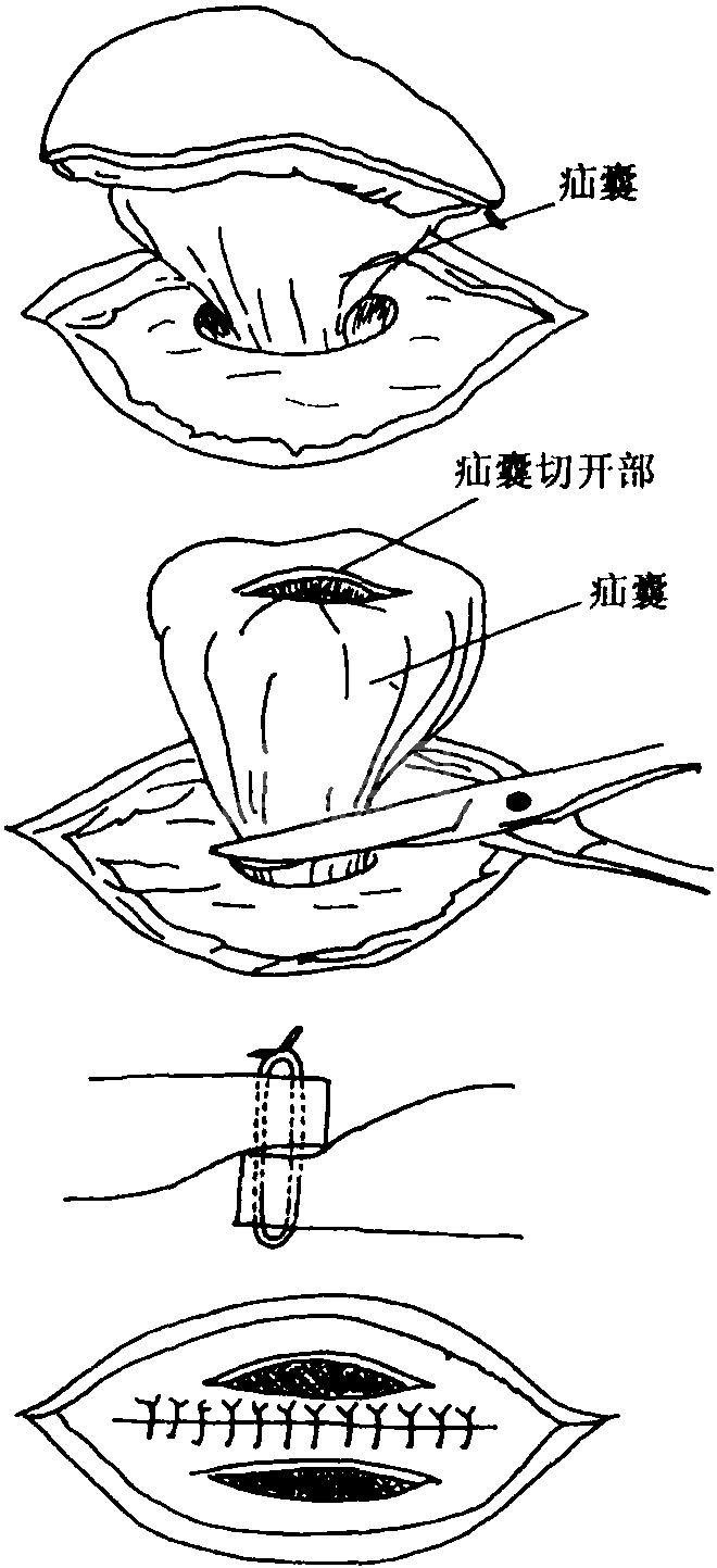 十三、伴有腹痛的疾病