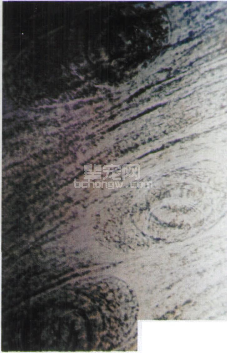 三十二、旋毛虫病