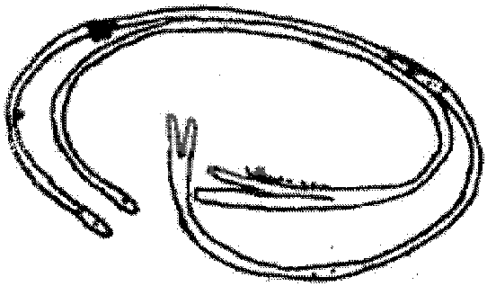附: 胚胎移植术