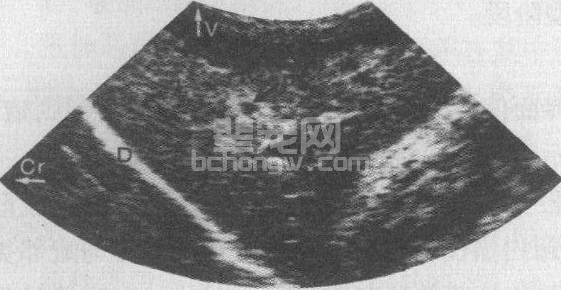 (五) 超声波检查