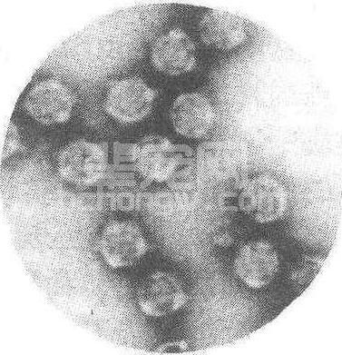 质型多角体病